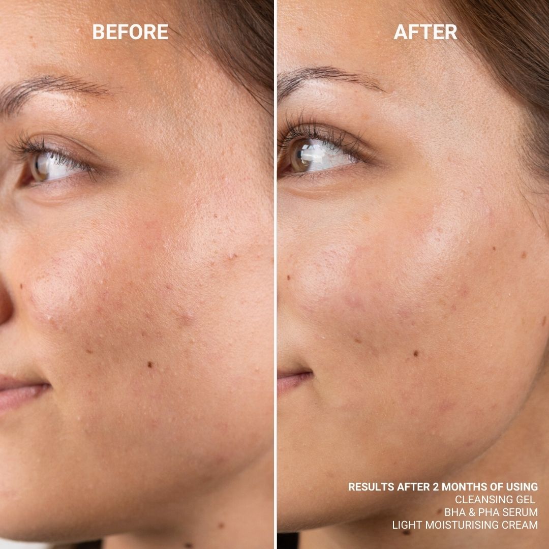 BHA & PHA SERUM