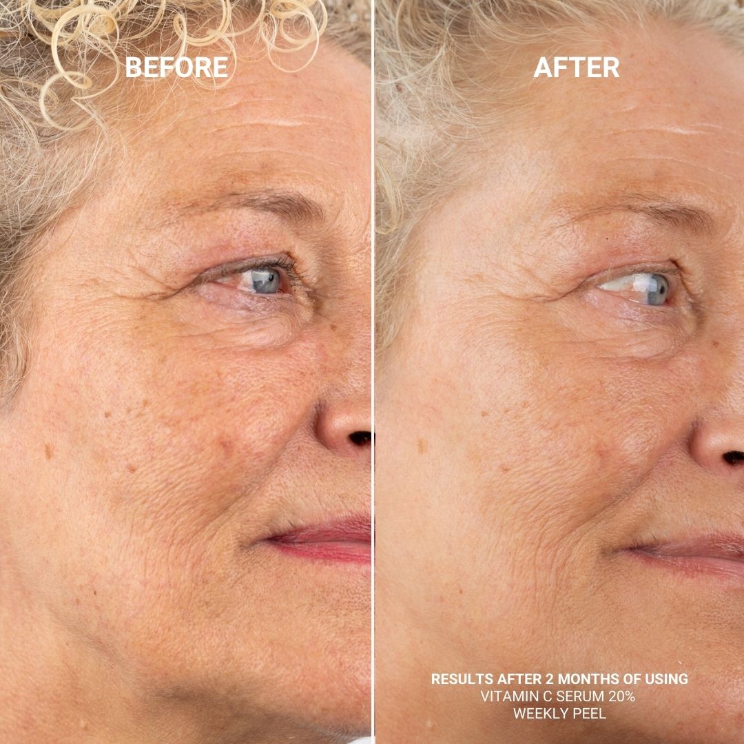 WEEKLY PEEL MED 28% AHA & 2% BHA