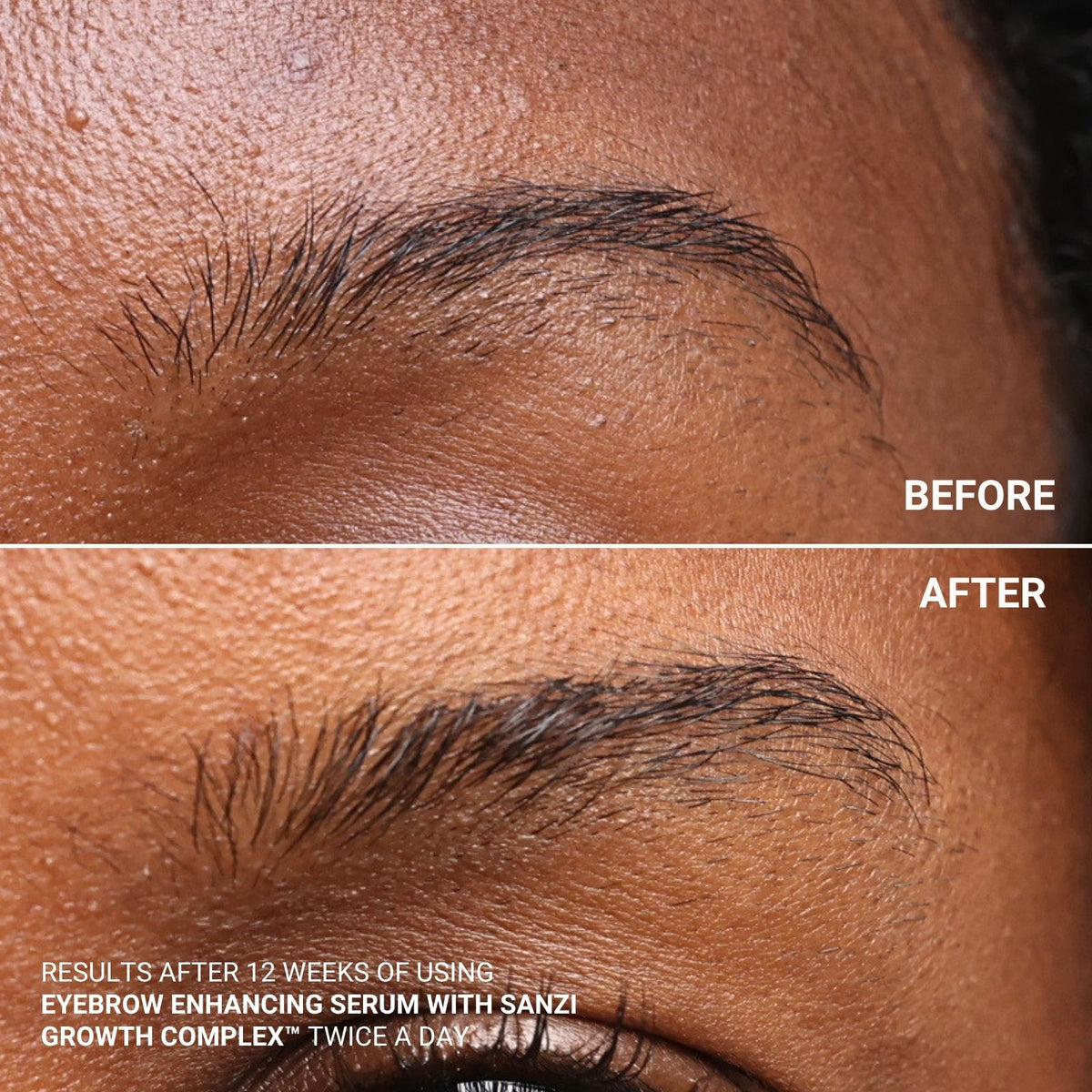 EYEBROW ENHANCING SERUM WITH SANZI GROWTH COMPLEX™