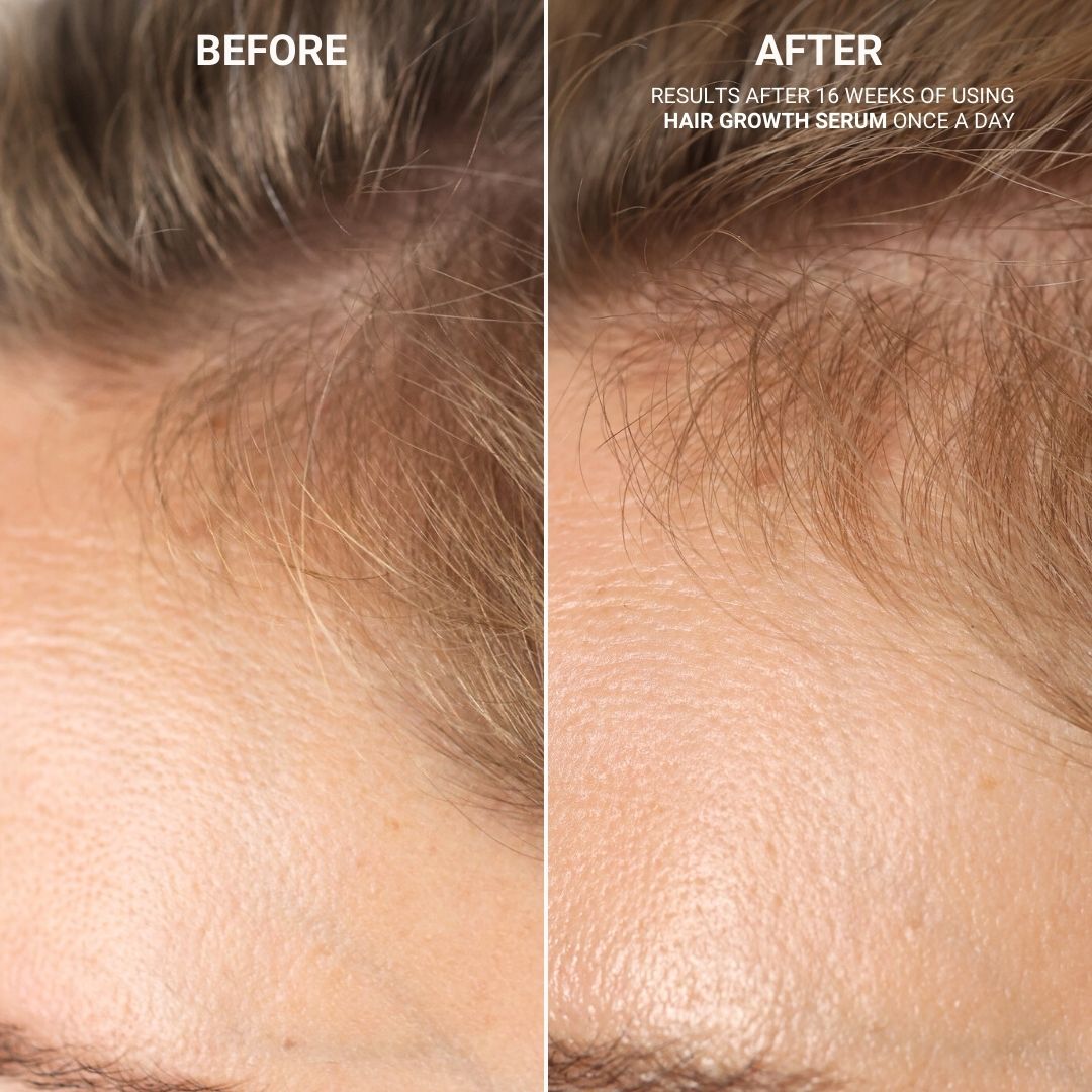 HAIR GROWTH SERUM WITH SANZI GROWTH COMPLEX™