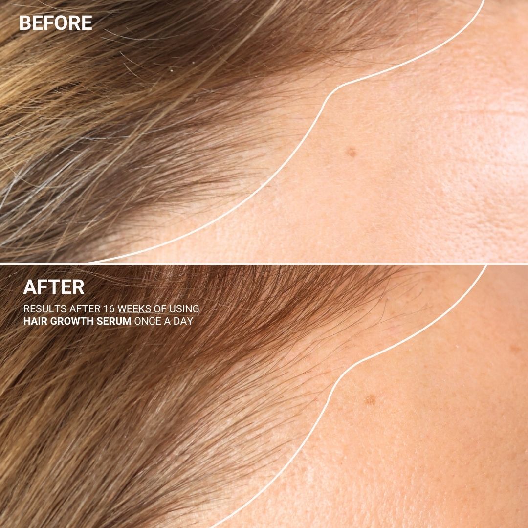 HAIR GROWTH SERUM WITH SANZI GROWTH COMPLEX™